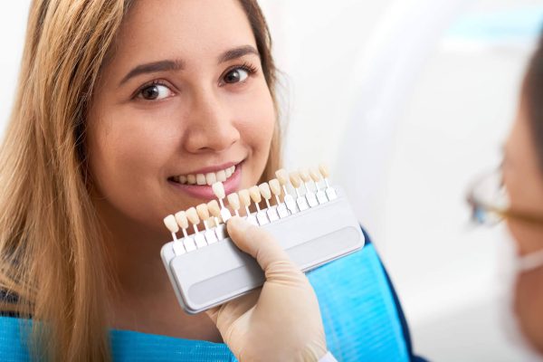 Smiling young woman having teeth color checking for veneers
